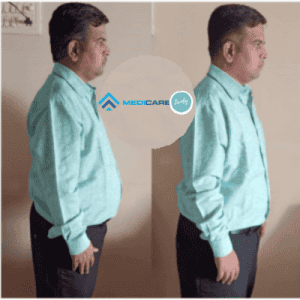 Deepak Ghadge’s Journey For Weight Loss